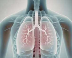 Insulin Resistance